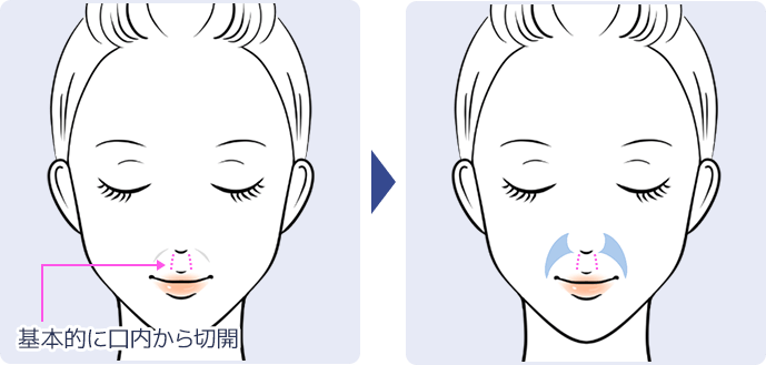 イラスト