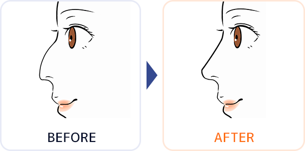 イラスト