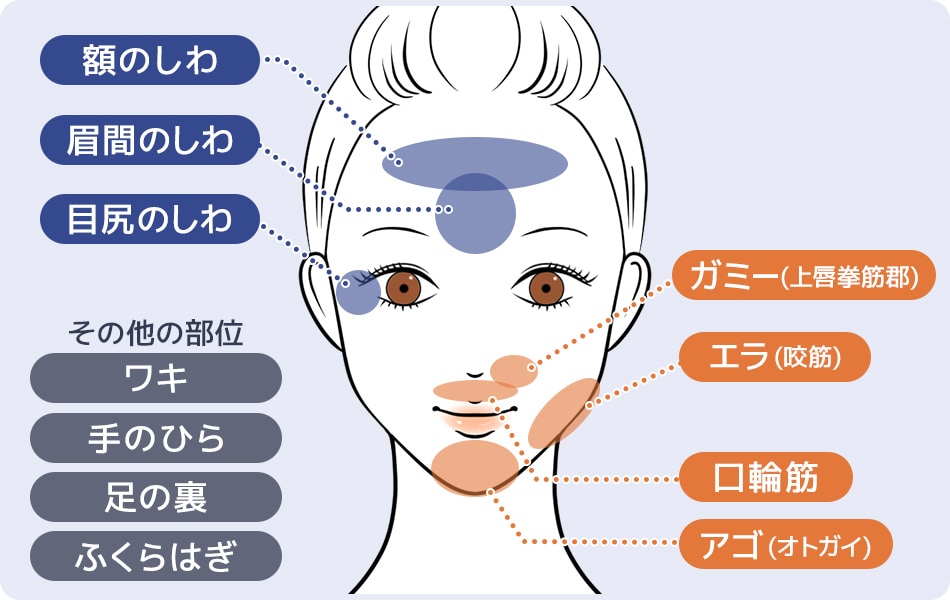 イラスト
