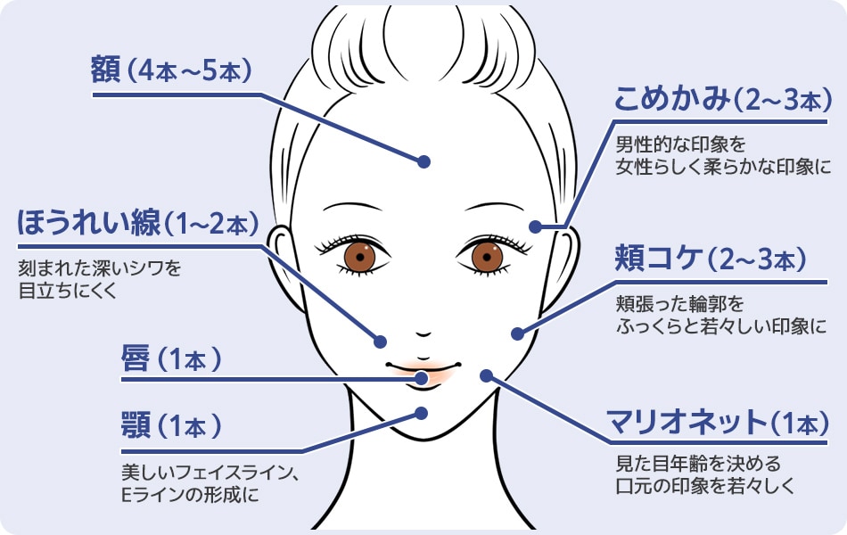 イラスト