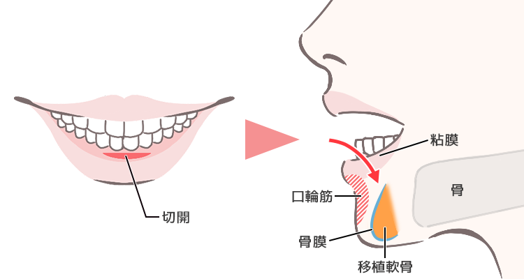 イラスト