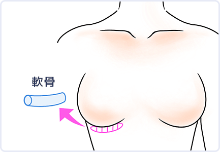 イラスト