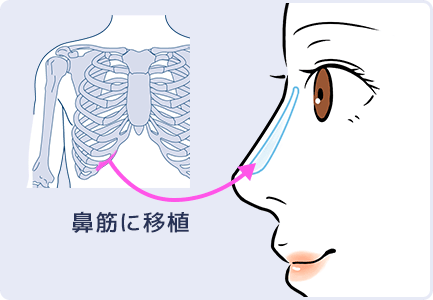 イラスト