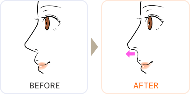 イラスト