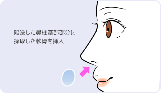 イラスト