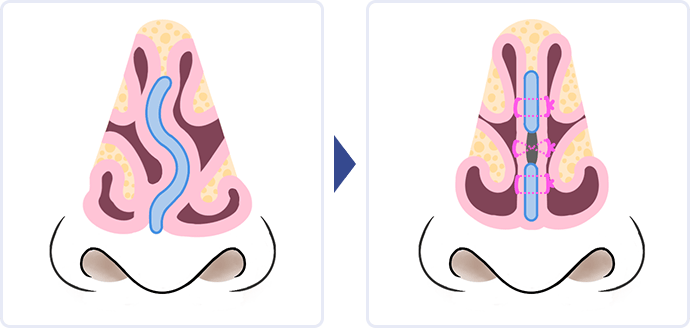 イラスト