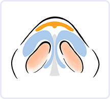 イラスト1