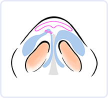 イラスト3