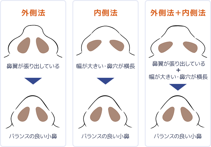 イラスト