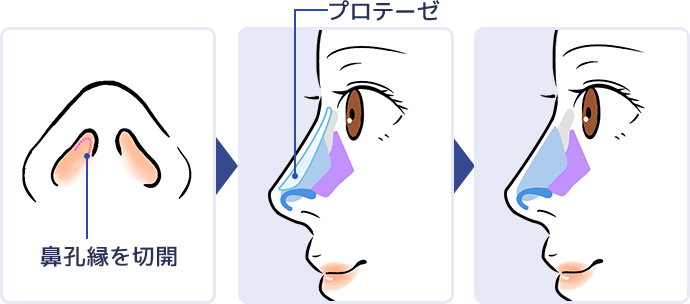 イラスト