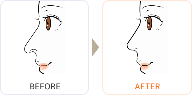 イラスト