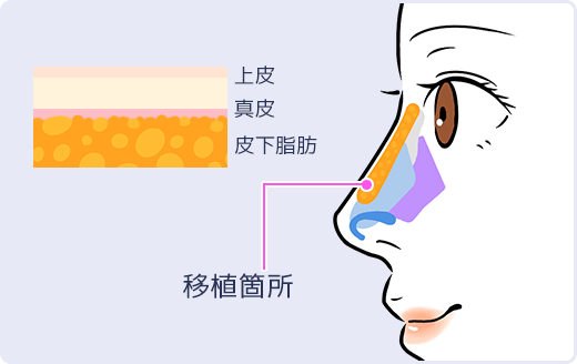 イラスト