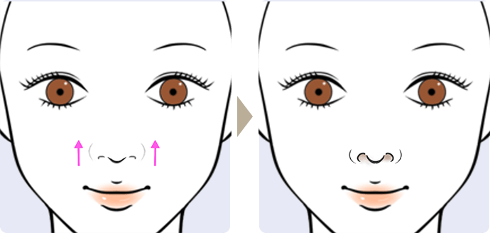 イラスト