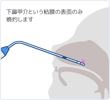 イラスト