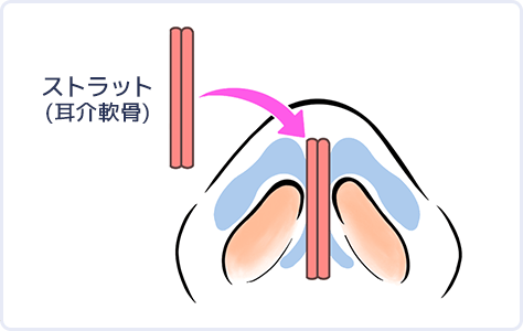イラスト